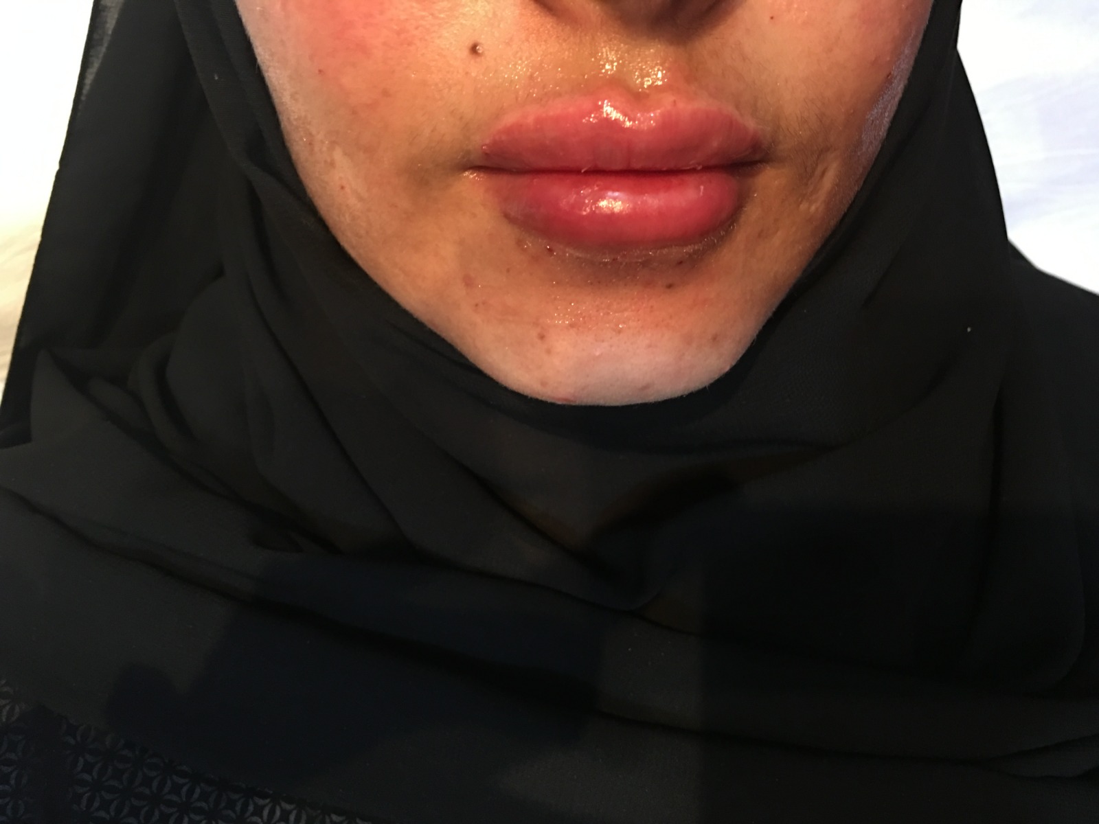 بعد
