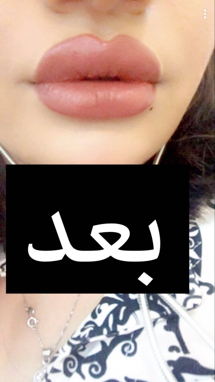 بعد