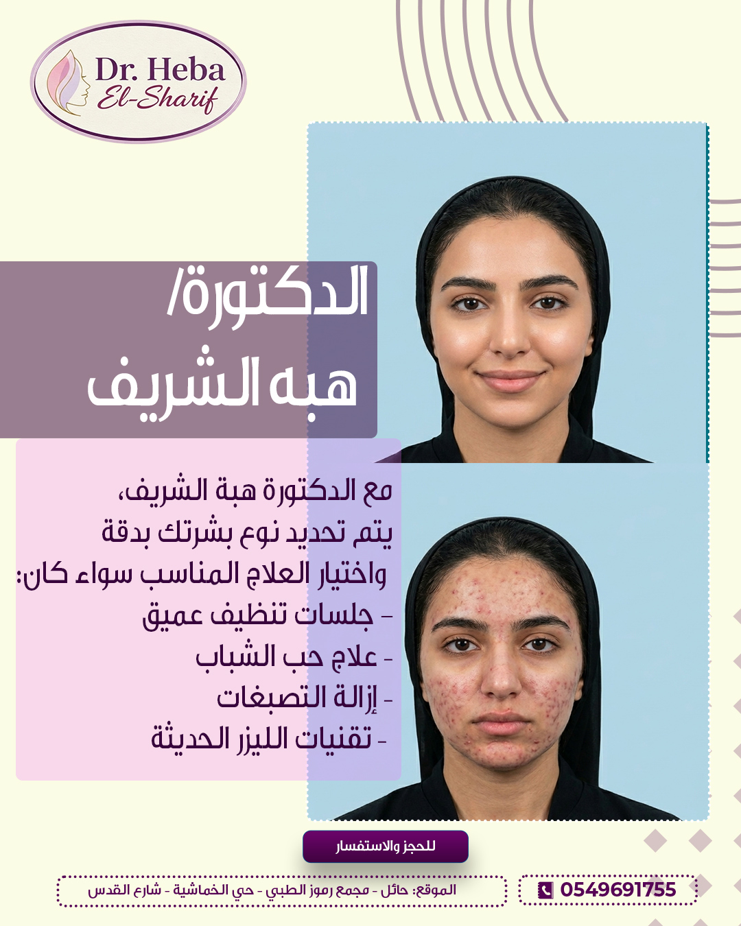 نتيجة علاج