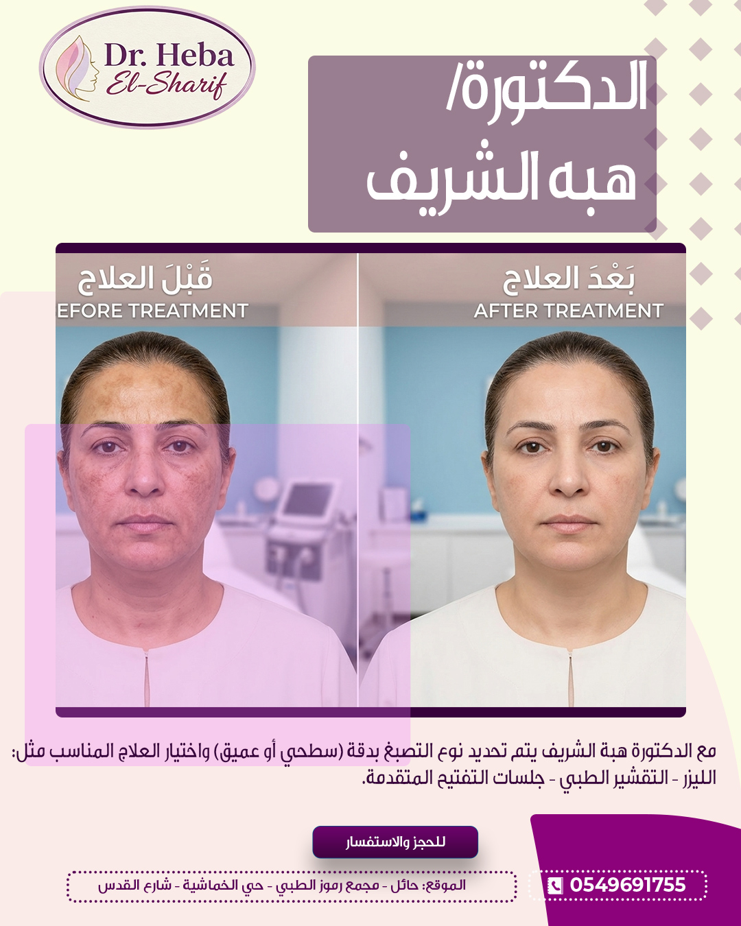 نتيجة علاج