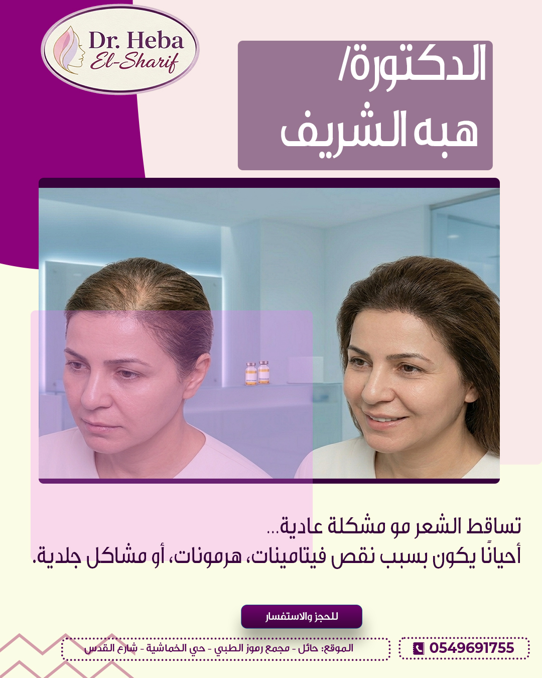 نتيجة علاج