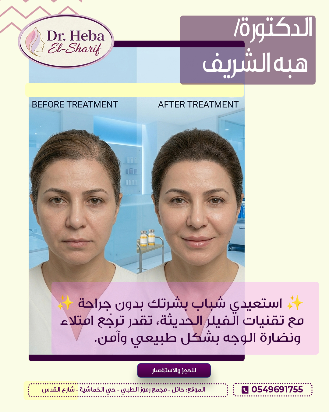 نتيجة علاج
