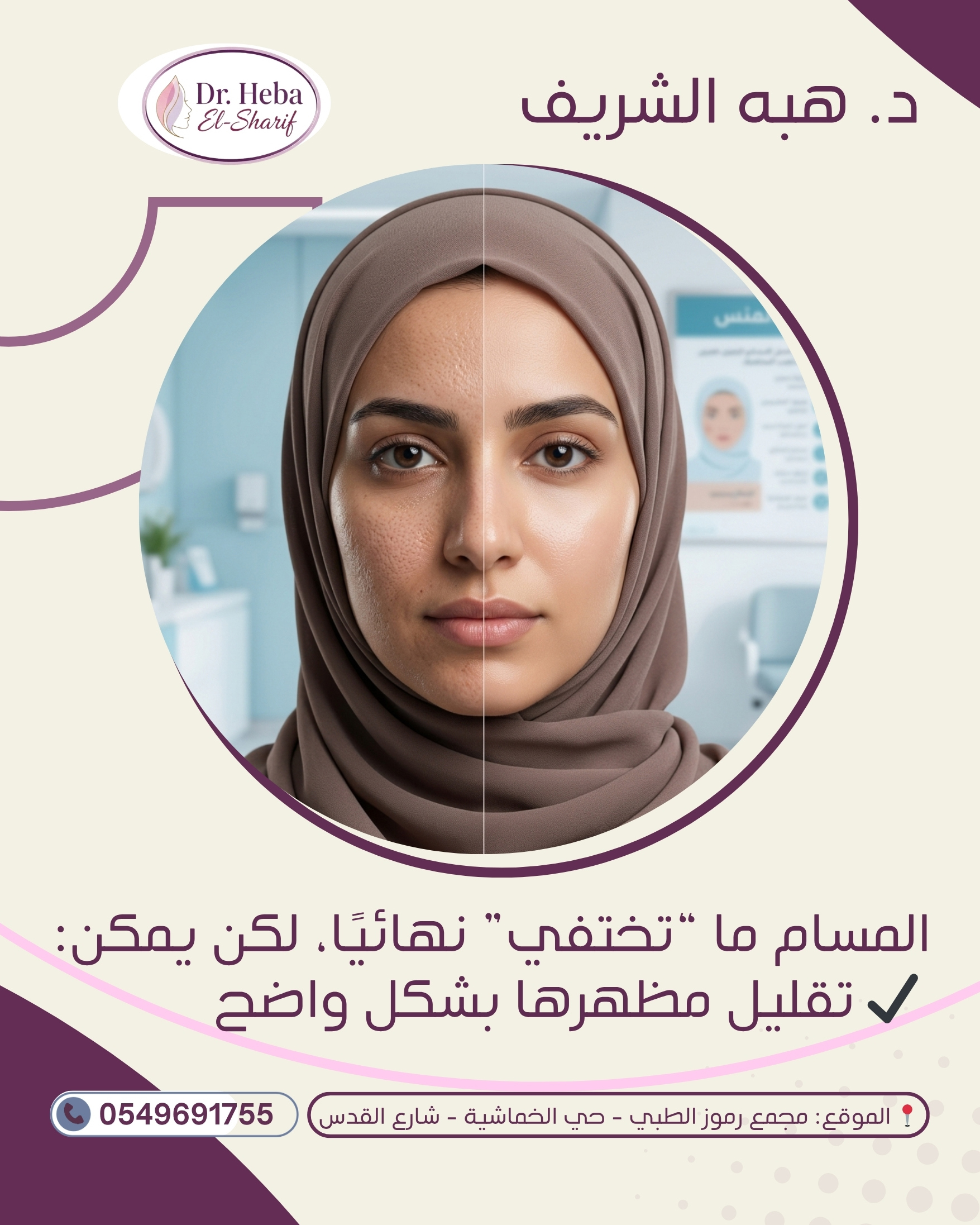 نتيجة علاج