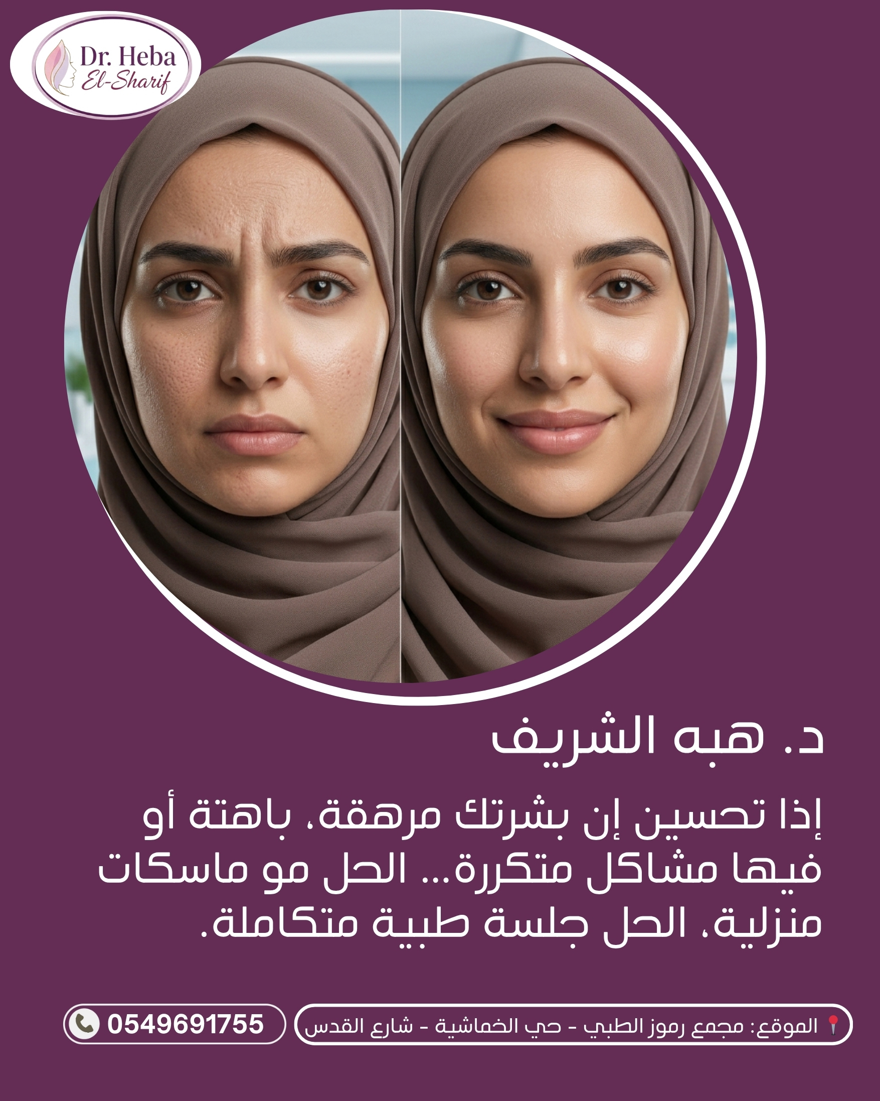 نتيجة علاج